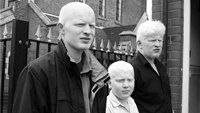 Albino Families