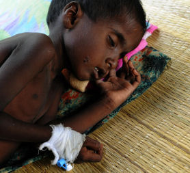 A wounded displaced Tamil child sleeps on the floor of a hospital in Chettikulam, northern Sri Lanka. (Getty)